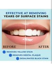 Venus Visage Award Winning Teeth Whitening Pen 2 Pens 20  Uses Low Sensitivity