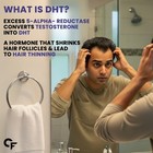 Carbamide Forte Dht Blocker With Biotin Tablets For Hair Growth   Biotin 60tab