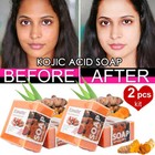 2 Pcs Tumeric Soap  Dark Spots   Skin Glow  Brighter Skin  Scars  All Skin Types