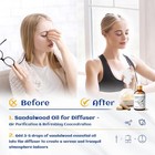 Sandalwood Essential Oils 1 Fl Oz  100  Pure Natural Therapeutic Grade For Skin 