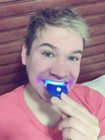 Teeth Tooth Whitening Whitener Bleaching Professional Kit White Gel Light 4pcs