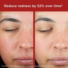 Elta Md Uv Skin Recovery Spf 50 Face Sunscreen 1 7oz Exp 05 27 New In Box Fast