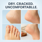 Aavini Foot Cream 50g     Repair Cracked Heels  Hydrate Feet   Eliminate Odor