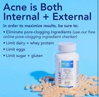 Clearstem  age acne  Mind-body-skin Vitamin 90 Capsules