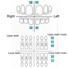 30pcs Dental Composite Porcelain Veneers Resin Light Cure Anterior Teeth Veneer