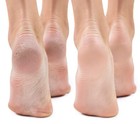 Heal rescue Heel Rescue Foot Cream  Unscented Foot Cream For Dry Feet  2-pack