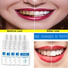5 3pcs Teeth Cleaning Gel Whitening Essence Serum Oral Hygiene Dental Care Serum