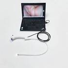 Single Use Rhinolaryngoscope 3 1-5 8mm With Usb Cable Hd Cam For Ent intubation