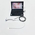 Single Use Rhinolaryngoscope 3 1mm 30cm Length With Usb Cable Mega Pixel For Ent