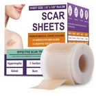 Silicone Scar Sheets  Medical Grade Silicone Scar Tape For Old   New Scars