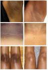 Dark Skin Bleaching Cream Whitening Lightening Aha - Face   Body  15g 
