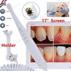 17 Inch Dental Intra Oral Intraoral Camera Wifi Definition Digital Monitor 8 Led