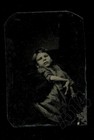 Rare Antique Tintype Of A Disabled Child Cerebral Palsy Not Post Mortem
