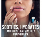 Chapstick Classic Medicated Lip Balm Tubes  Chapped Lips Treatment And Skin Prot