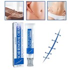 1-5 Box Scar Removal Cream Skin Repair Scar Remover   fade Stretch Mark   acne
