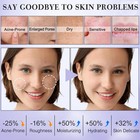 Skin Care For Teens gentle Hydrating Skin Care Set Kit With Clean Ingredients da