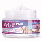 Scar Cream Scar Removal Cream Rapid Repair Of New Old Scars burns All Natural