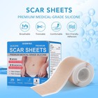 Silicone Scar Sheets  1 6  X 60  X 2 Roll silicone Scar Tape For Surgical Scars