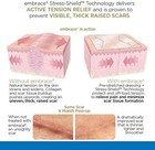 Embrace Active Scar Defense For New Scars  Fda-cleared Medical-grade Silicone