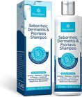 Seborrheic Dermatitis   Psoriasis Treatment  Dry Itchy Scalp Treatment 06 2028