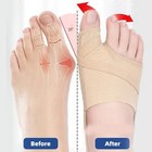 2x Big Toe Bunion Corrector Splint Straightener Foot Pain Relief Hallux Valgus
