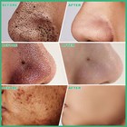 Purifying Mask Blackhead Remover Purifying Acne Peel-off Mask    facial Cleansing