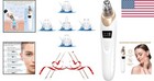 2023 Blackhead Remover Pore Vacuum Kit - Usb Rechargeable   Adjustable Suction