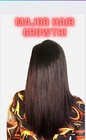 Major Hair Growth Oil- Natural Growth Serum For Thin Hair  Balding  Alopecia 2oz