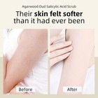 Facial Scrub Microdermabrasion Organic Face Scrubs Exfoliator For Dead Skin Blac