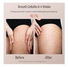 3-in-1 Body Sculpting Machine With Red Light  Vacuum   Microcurrent