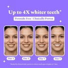 Perfora Purple Teeth Whitening Strips     Pack Of 3 Treatments  6 Strips  