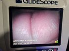 Verathon Glidescope Avl Video Laryngoscope Monitor With Power Supply   Tested 