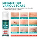 Advanced Silicone Scar Gel  Scar Removal Gel 1 7 Oz  50 G  - Scars Relief