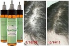 Beanstalk Hair Loss Treatment Growth Oil  Promotes Fast Hair Growth In 2 Weeks