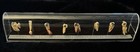 Vintage Dental Anatomy Pathology Teaching Specimen Display Teeth German Labels