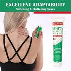 Advance Silicone Scar Cream Gel  Old   New Scars Treatment Stretch Green