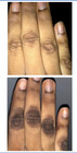 2pk- Dark Knuckle Skin Whitening Kojic Acid Aha Lightening Bleaching Oil   Cream