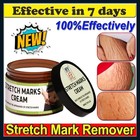 Best Scar Old-scars Stretch Mark Removal Cream For Men   Women 1 76oz Usa