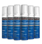 6 Month Kirkland Minoxidil 5  Foam Hair Regrowth Men Exp 10 2026  Costco Sealed