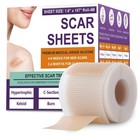 Medical-grade Silicone Scar Sheets   Tape For Effective Scar Healing - 4m