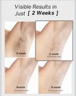 Blex Ipl Laser Hair Removal System Black Permanent Hair Removal