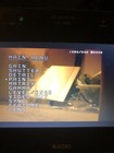 Iconix Hd-rh1 Hd Camera Head  Ccu  Power Supply  Cable And Monitor Tested