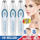 4x Tag  spot Eraser Mole Skin Tags Removal Tool Eraser Pen Painless Long-lasting