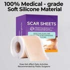 Silicone Scar Sheets  1 6  X 120  Roll- 3m  Silicone Scar Tape For Surgical Scar