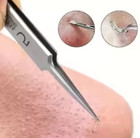 Blackhead Remover Tool Acne Needle Tweezers Pimple Extractor Stainless Steel