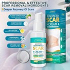 Best Scar Removal-cream For Old-scars Stretch Mark Removal Cream Unisex 50g