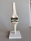 1 1 Artificial Knee Joint Medical Anatomical Skeleton Demo Display Model