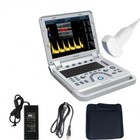Portable Ultrasound Scanner Cf Color Doppler With Abdominal Probe For Medical Us