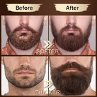 Xikezan Beard Kit For Men Grooming   Care Set W 2 Pack Beard Serum  Wash  Oil  B