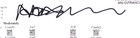 Ani Difranco Signed 8 5x11  Cardstock Sheet Music Page Not Pretty Girl Autograph